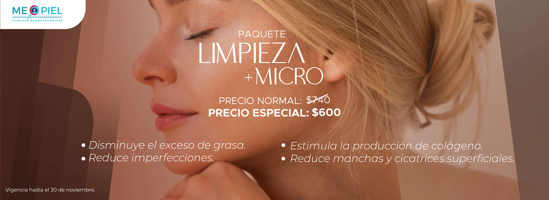 BANNER-LIMPIEZAMASMICROPROMOCIONNOVIEMBRE